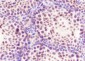 SF1 Recombinant Rabbit mAb